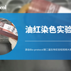【Bio-protocol】油红染色实验
