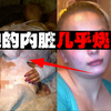 【少女焚烧案】以为烧尸灭迹，结果烧一晚上得救存活