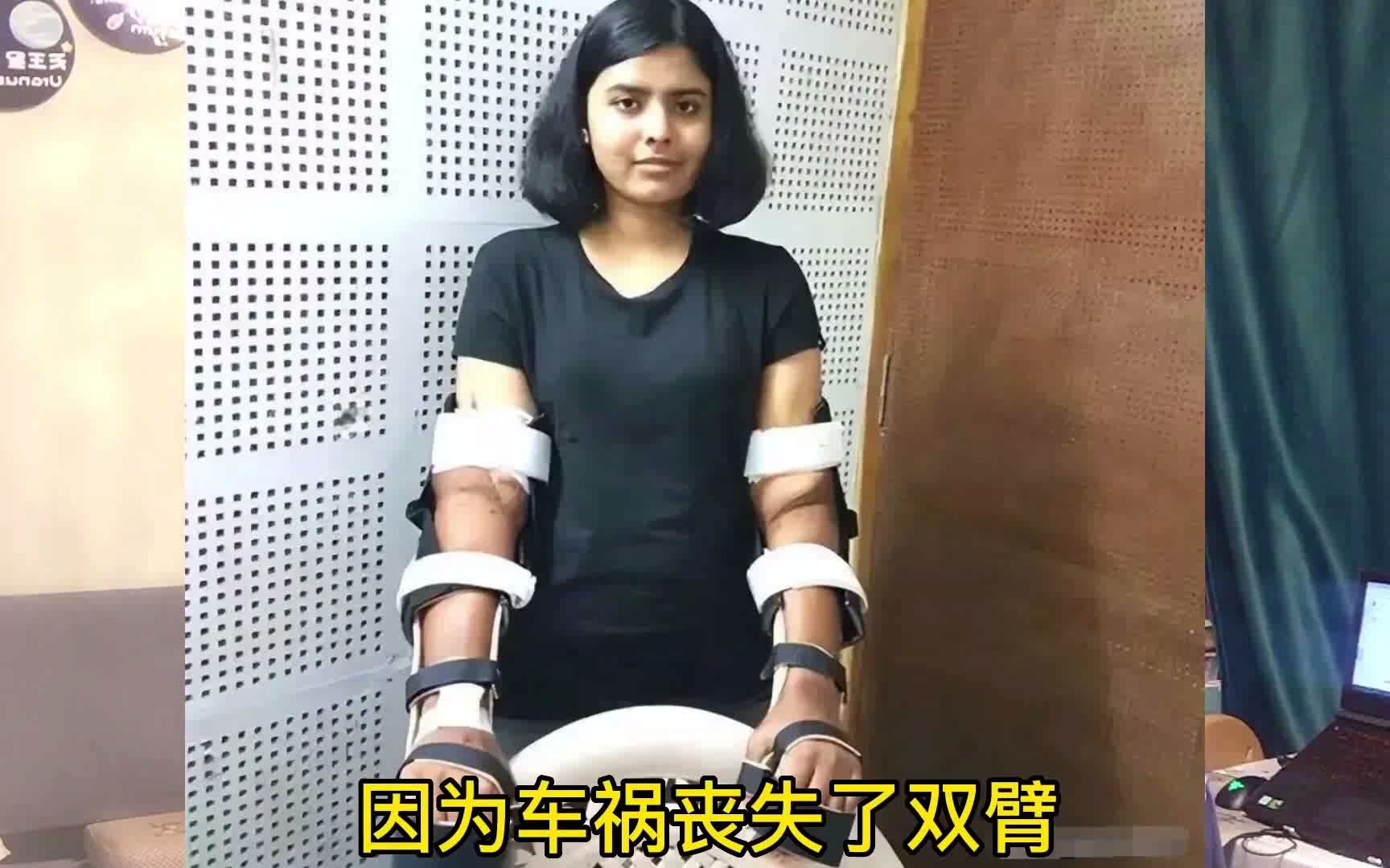 印度女孩在车祸丧失双臂，移植了黑人男子的手臂，发生神奇一幕.