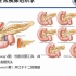 1.胰腺基本病变：影像与病理-胰腺疾病影像诊断系列