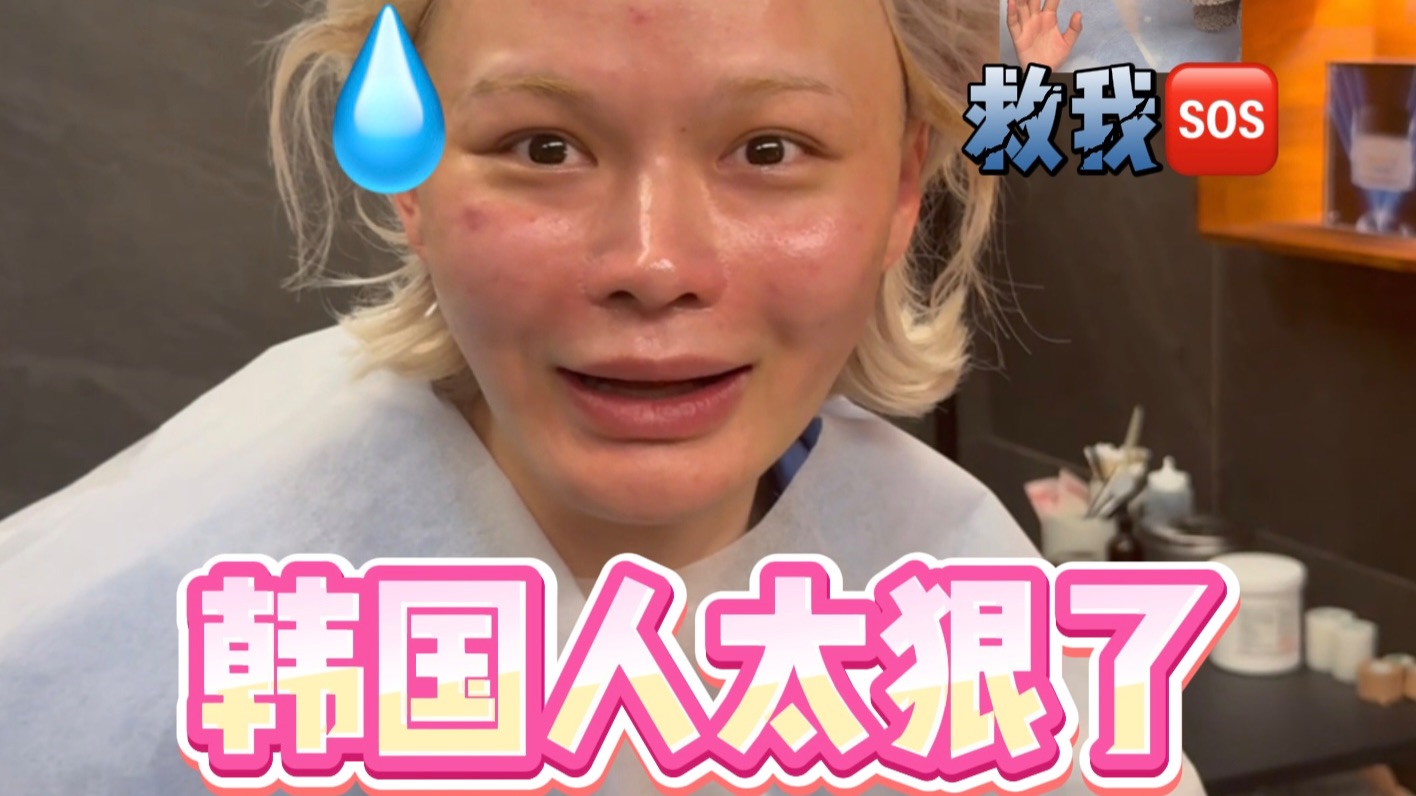 第一次被打成这样…