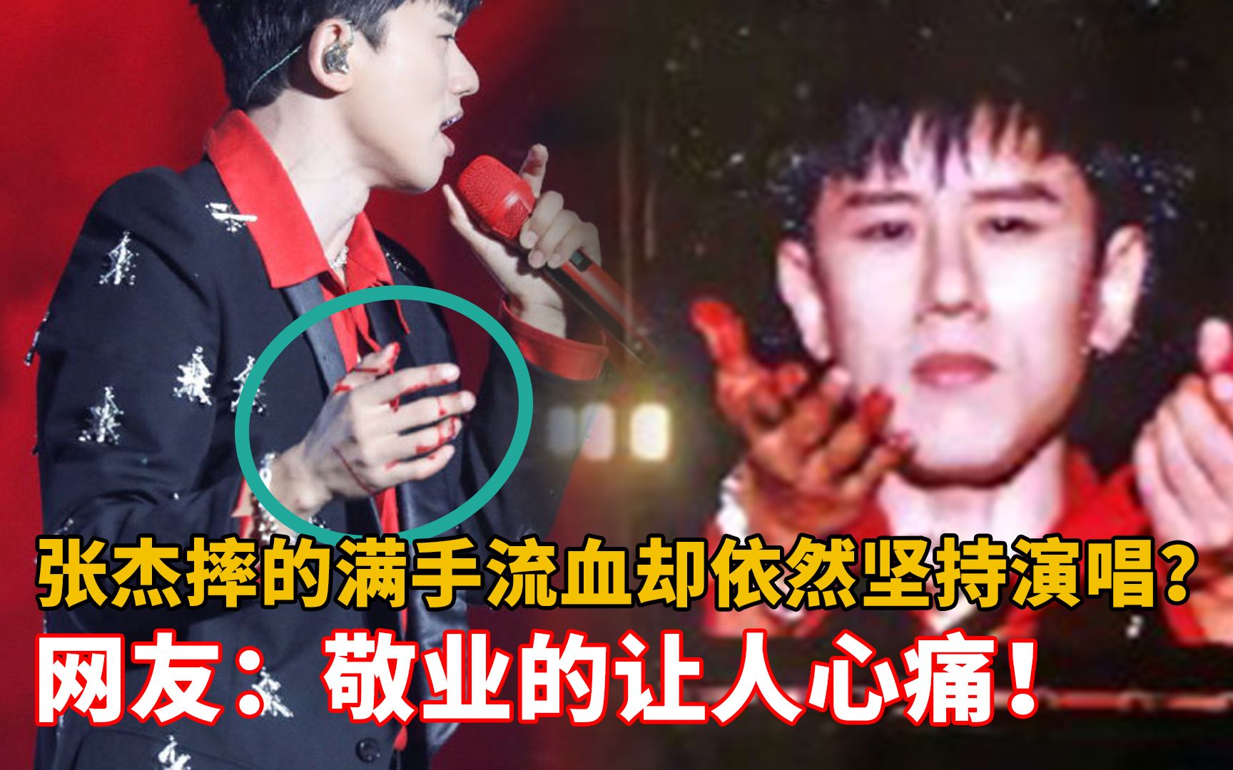 活动作品张杰摔的满手流血却依然坚持演唱网友敬业的让人心痛
