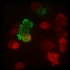 【肿瘤学】细胞毒性T细胞攻击癌细胞2