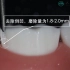 下颌第一磨牙烤瓷冠牙体预备术