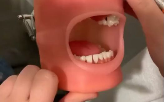 “牙医通常希望我们能把嘴巴张大一点，比如这样……”