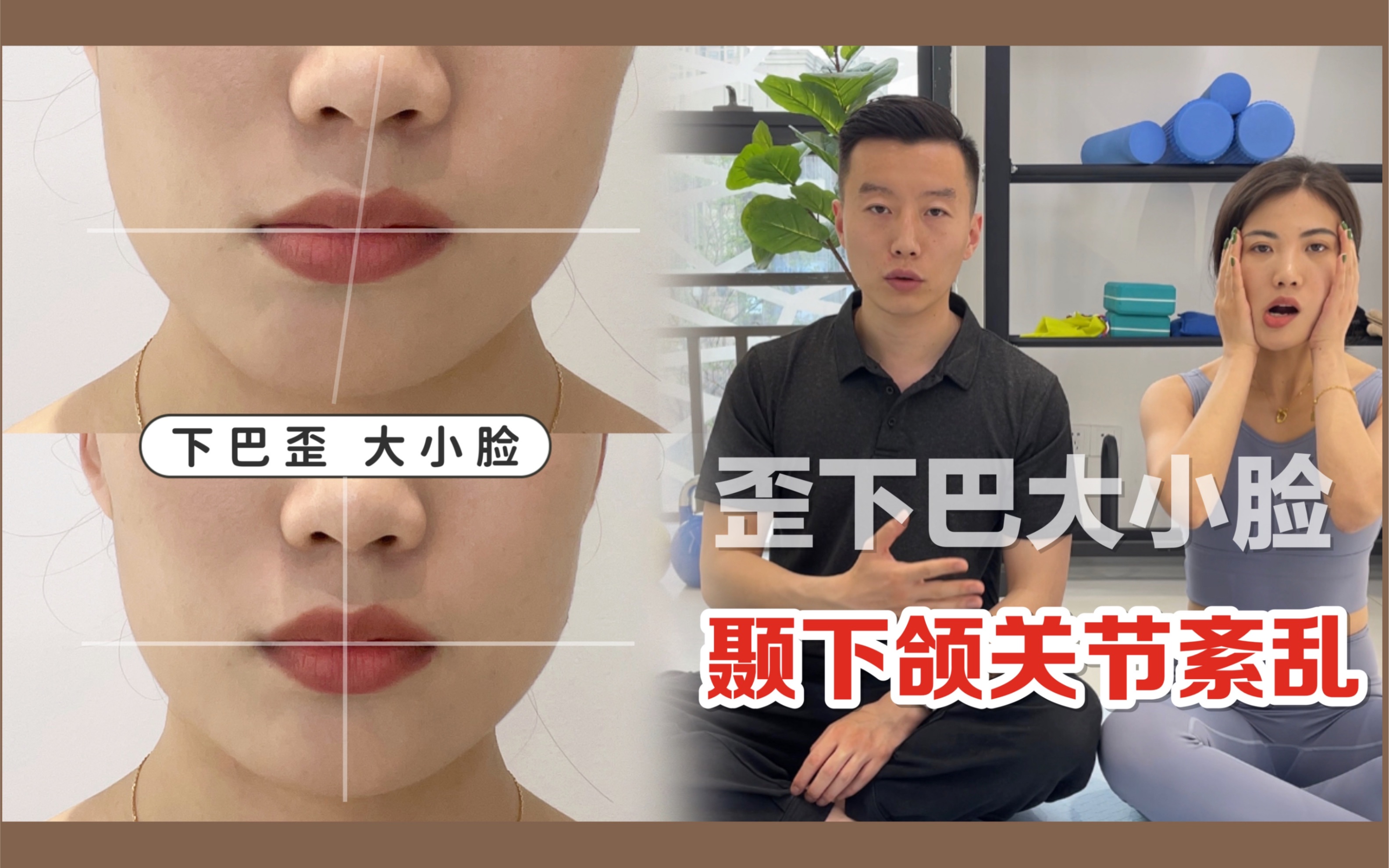 「雙下巴」不只是一個部位的治療 - P.SKIN 彭賢禮皮膚科│國際皮膚科-100%皮膚專科講師級醫生團隊