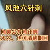 风池穴针刺(向鼻尖方向针刺，祛风大穴，也可清利明目)-刘老师