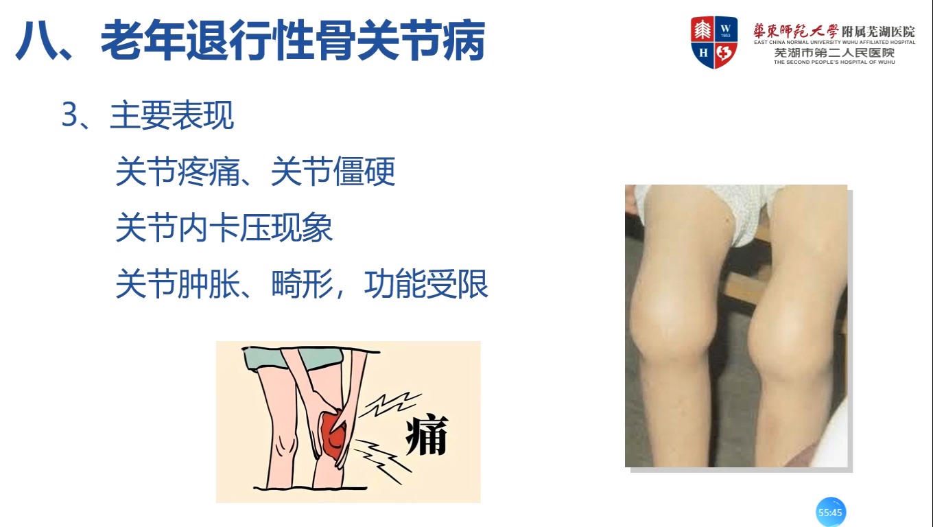 10医疗护理员培训——老年人的生理心理特点及常见疾病