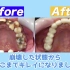 大多数日本人牙齿都不好看，背后的原因值得我们警惕！
