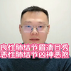 如何判断肺结节的良恶性