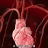 机器人心脏血管搭桥手术过程，3D演示。。