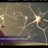 3D医学动画：癫痫的发作原理