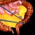 腔镜微创左侧部分结肠切除术，3D演示。。