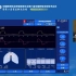 机械通气模式演示