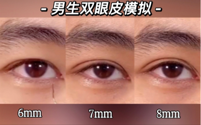 男生的双眼皮模拟！6mm、7mm和8mm，哪个是你的心动款？