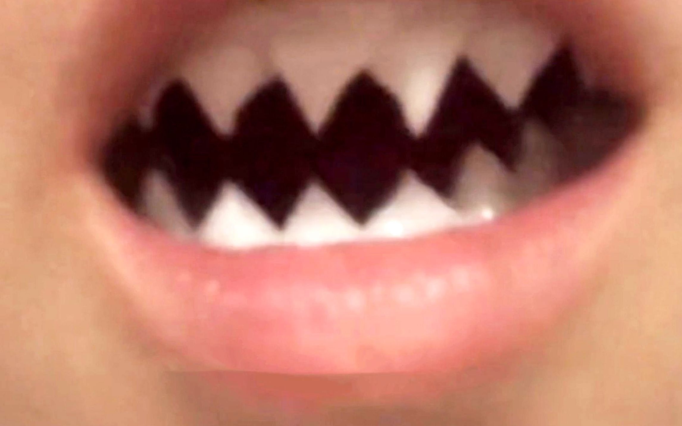 就这牙齿，咬到舌头肯定很疼吧