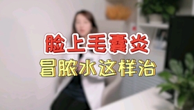 2cd7829a014b7654ff7ef8a21982488489b46782.jpg@280w_158h_1c_100q.jpg