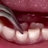 儿童牙齿早期干预矫正一定要重视起来