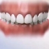 很多人嘴吧凸出，其实都是牙齿深覆盖导致的。矫正牙齿就可以