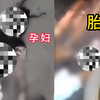孕妇散步被大车碾压，胎儿当场挤掉出来，太惨了