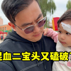 二宝头磕破了，缝了两针，看着真心疼