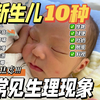 新生儿10种常见的生理现象✅新手爸妈不必过度慌张