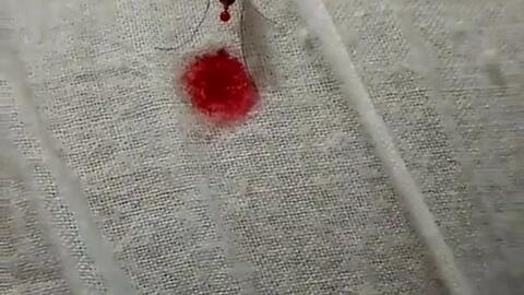 肚子常常拉稀怎么回事 321d1a7410d4c7428b25a1ff4227910b50a1f305.jpg@480w_270h_1c