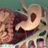 3D医学视频：胃部大出血手术！