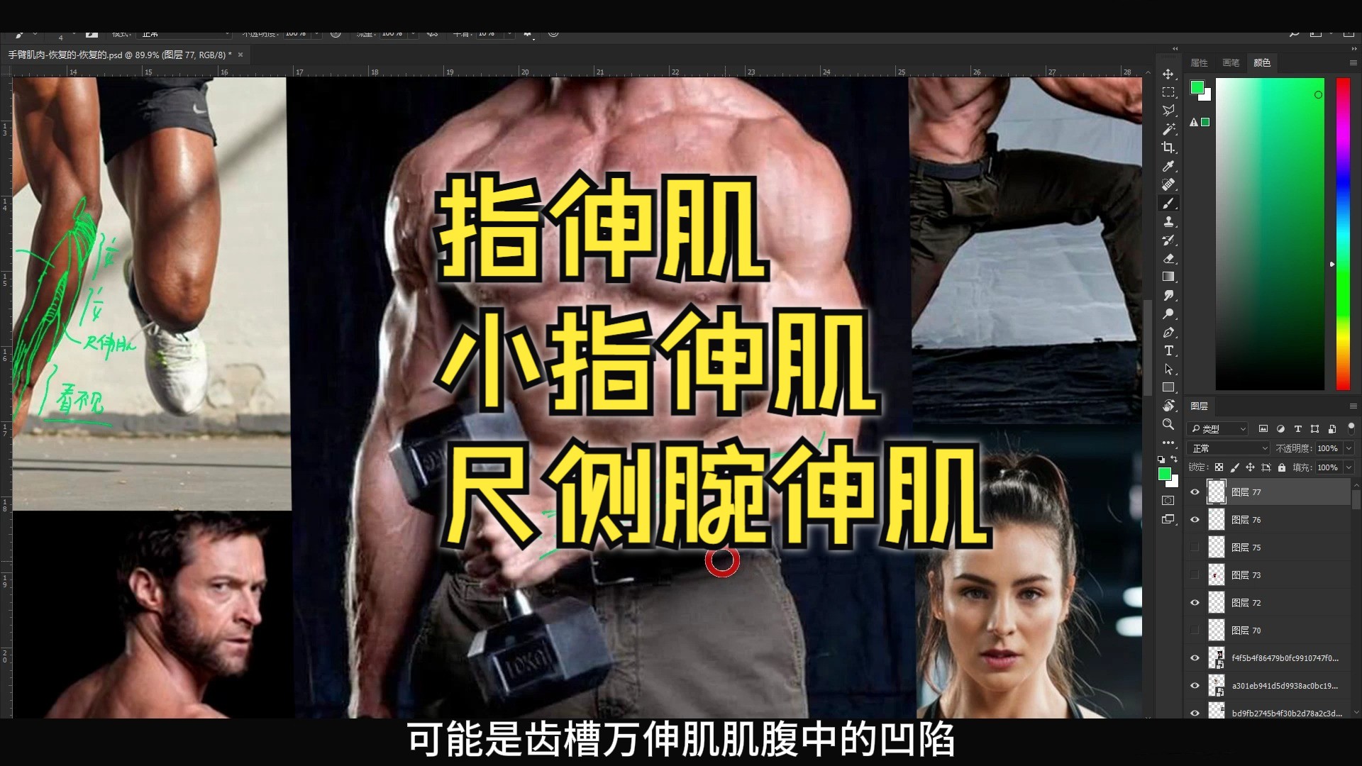 【手臂干货】指伸肌、小指伸肌、尺侧腕伸肌——结构分享，别错过！