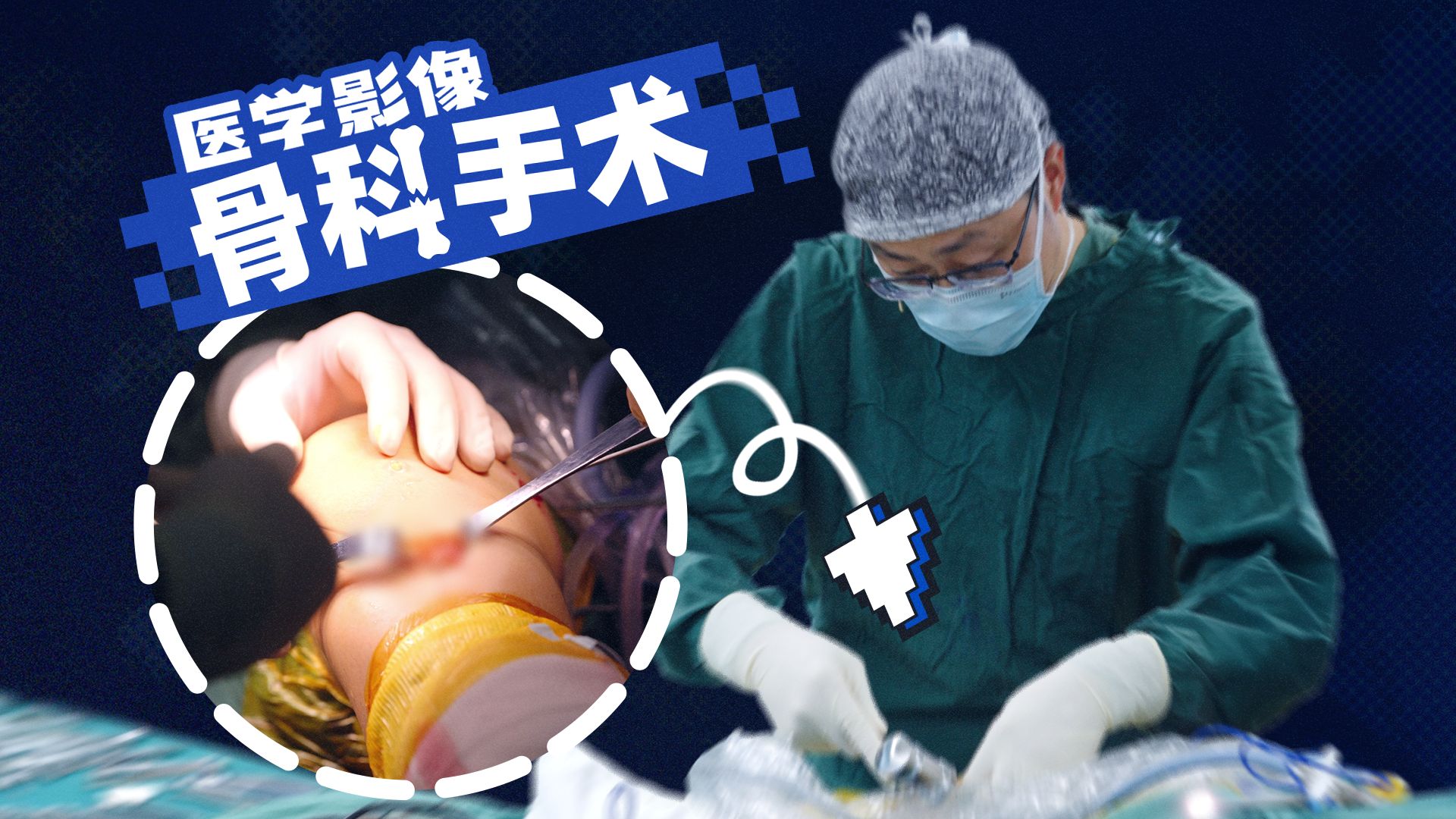 在膝盖上钻洞？我们拍下了骨科手术全过程！