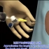 3D医学视频演示胸腔穿刺术