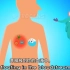 医学科普动画：我们为什么会发烧？