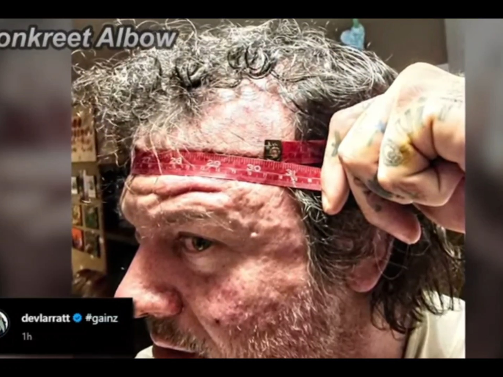 逆天德文头围比臂围长的都快，爆增20cm头围