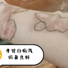 “白癜风”恢复需要一定时间！当皮肤白斑不再扩散，趋于稳定，白斑区域出现黑色素加深，表示开始恢复