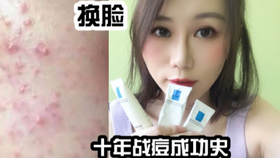 脸怎么能变光滑 3e81efb03baf2d62a91c10996a1a7af024d4d0c1.jpg@280w_158h_1c_100q.jpg
