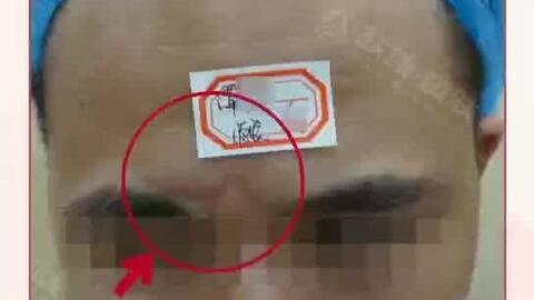 有什么好的祛疤痕方法 3eae248155905365ac8d15e8cac827e494ea3008.jpg@480w_270h_1c