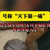 号称“天下第一痛”的带疱后遗神经痛，到底有多疼