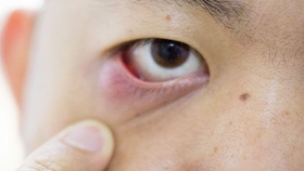 什么方法可以改善眼睛散光 3f10a2a08186c191330e205a6211ce436e3425b2.jpg@280w_158h_1c_100q.jpg