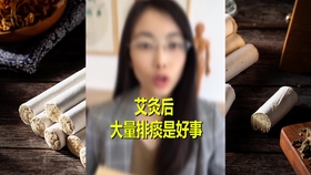 多少岁开始老花了 3f469a1604bac38cbb0ccf116adce37a290e1626.jpg@280w_158h_1c_100q.jpg