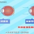 什么是角膜塑形术？动画科普告诉你