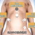 3d医学动画：微创腹腔镜手术  ·直肠癌切除手术