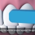 最正确的刷牙方法，3D演示。。