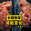 长期憋尿，你的肾脏会经历哪些惊人的变化