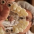 【鹏城健康大讲堂】88-2：除了材质方面，还有哪些选择种植假牙的参考条件