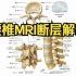 腰椎MRI断层解剖、腰椎大体解剖
