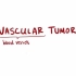 【搬运osmosis】Vascular tumors (kaposi, hemangioma, angiosarcoma