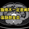 年轻人右下腹疼痛，一定是阑尾炎吗？用CT告诉你可能不是！警惕盲肠憩室炎