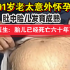 91岁老太意外怀孕，肚中胎儿发育成熟，医生：胎儿已经死亡六十年了