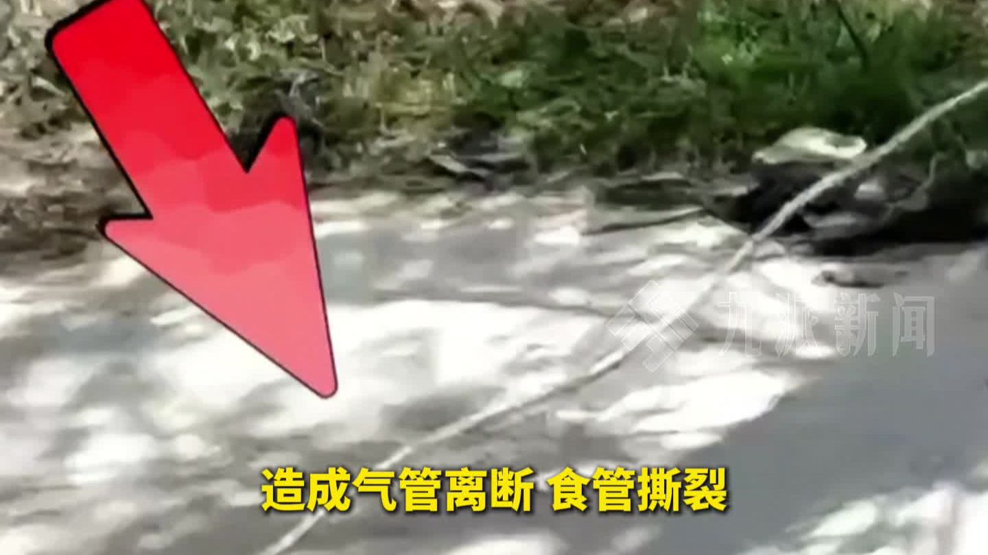 13岁男孩骑车被老人私拉的绳索割喉 ，忍痛跑回家求救