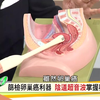 很重要！女性必做的4大妇科检查
